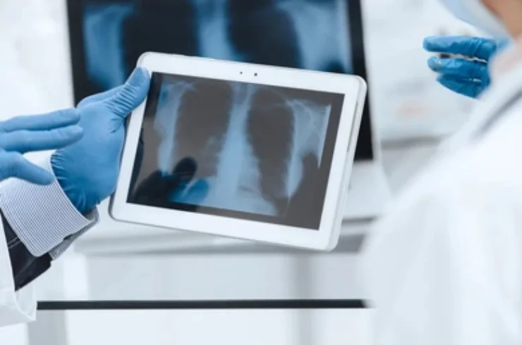 Digital X-Ray